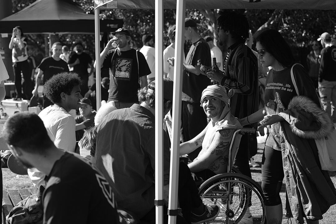 Javier Coca was enjoying the sun after 4 days in hospital with a badly broken ankle